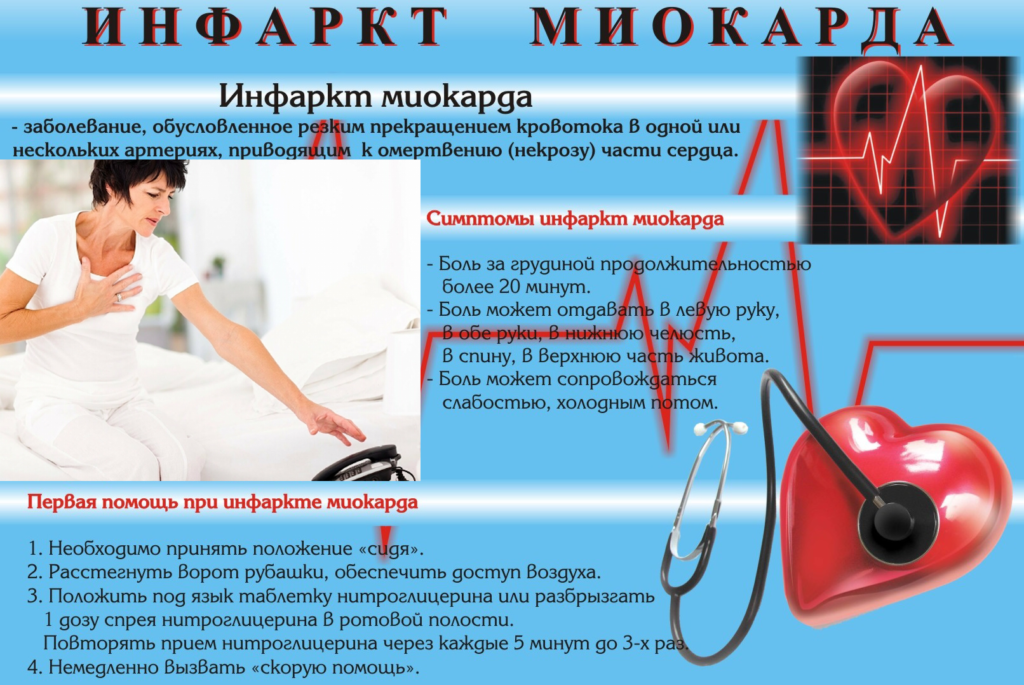 Инфаркт миокарда 2